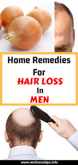 Aloe is an amazing home remedy for hair loss due to a dry or infected scalp. Home Remedies For Hair Loss In Men Hair Hairloss Haircare Homeremedies Naturalremedies Men Heal Hair Loss Remedies Home Remedies For Hair Hair Loss Men