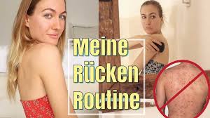 Ich hab auf dem rücken auch ein paar pickelmale bzw. Meine Rucken Routine Endlich Pickelfrei Youtube