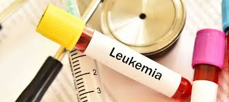 Image result for Leukemia