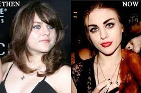 She is known for her work on cobain: Frances Bean Cobain Plastische Chirurgie Vor Und Nach Dem Foto