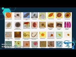 Practica Nº 4 Observacion De Parasitos Intestinales En Vegetales Youtube