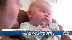 Poplar Bluff baby born with rare genetic disorder