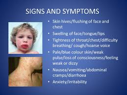 It typically causes more than one of the following: Medical Emergencies Anaphylaxis Asthma Epilepsy Diabetes Cpr Ppt Video Online Download