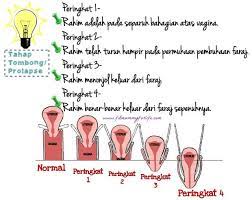 27.03.2017 · keluarnya darah saat berhubungan intim untuk pertama kali, seringkali dijadikan indikator untuk menentukan perawan atau tidaknya seorang perempuan. Tombong Jatuh Atau Penawar Masalah Sakit Puan Facebook