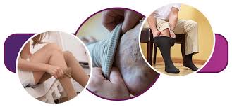 Os benefícios surpreendentes das meias de compressão: Por que você precisa  delas agora | Servimedic Technology