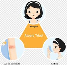 Image result for Allergic Triad