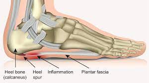 We update the list regularly. 10 Common Foot Problems And How To Manage Them Everyday Health