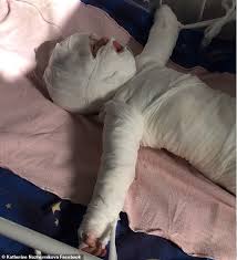 All five of your little one's senses — vision, hearing, taste, touch, and smell — have come a long way since delivery day. 11 Months Old Baby Falls Into The Pot Of Boiling Water While Bathing Very Seriously In The Hospital