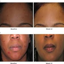 Jillian Capodice's research works