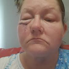 OPEN FROM 18th APRIL 🏕️ Back to Basics Camping ✓ Choose your own pitch. 🚰  Drinking water. 🧼 sink for washing up. 🚾 toilet block 🚮 Rubbish Bins 🏕️  3 fields to