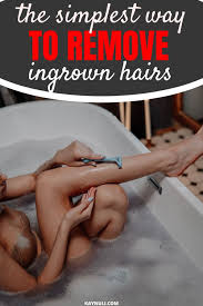 I hope you guys have enjoyed this video on how to properly remove hair to prevent and eliminate ingrown hairs, razor bumps, dark spots and infection around. Easy Way To Remove Ingrown Hairs Quickly Kaynuli