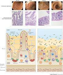 Maybe you would like to learn more about one of these? Regional Specialization Within The Intestinal Immune System Nature Reviews Immunology