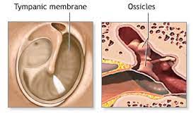 Tympanoplasty With Ocr In Iran With Dr Saeedi At Affordable Cost