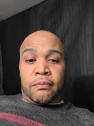 FIGHTNING INJURIES Prosthetics created with gelatin, painted with Alcohol  activated makeup.