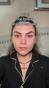 hermana slaaaay #botox #cara #frente #skincare #fyp #parati #ferpuebla