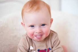 Can Teething Cause Rash Kids Allergies Itching Skin Allergic Reaction