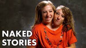 Abby and brittany hensel are conjoined twins. Abby And Brittany Hensel Are The World S Most Famous Conjoined Twins