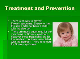 Trisomy 21 Down S Syndrome Ppt Video Online Download