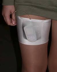 Insulin Pump Holder Good For When Wearing A Dress Very Cool Insulin Pump Type One Diabetes Insulin Pump Bands