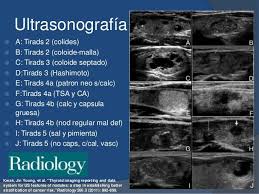 Image Result For Tirads Radiology Imaging Radiology Interventional Radiology