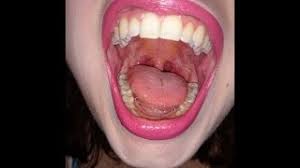 Swallowing Gummy Worms Whole And Some Chewing Youtube