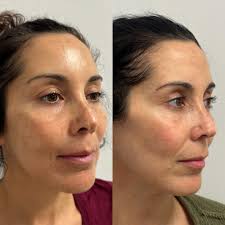 Danielle Stark, PA-C