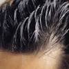 Do certain hairstyles cause hair loss? 1