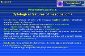 The dense cytoplasm of egfr and alk. 02 Presentations Ii Vs 14 4 Mb 3 30 08