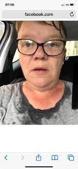 A woman who sweats litres of liquid daily has opened up about the struggles  her condition causes. Darcie Hamilton, 22, says she has battled with the  condition since she was around 10