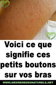 Pin On Sante Et Bien Etre
