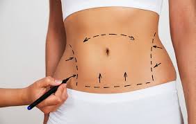 5 Things Dr Miami Says He Wishes Patients Knew About Plastic Surgery Tummy Tuck Surgery Plastic Surgery Procedures Tummy Tucks