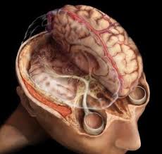 Brain And Optic Nerve Image Brain Anatomy Medical Anatomy Eye Anatomy