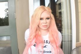 albinism share their makeup routines