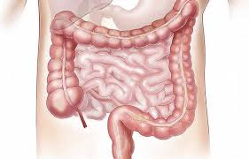 Image result for Adynamic Ileus