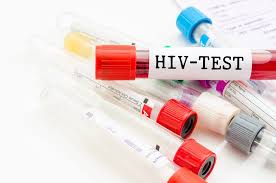 Women account for nearly 63% of all new infections. African Countries Differ Widely In Prenatal Hiv Testing Why It Matters
