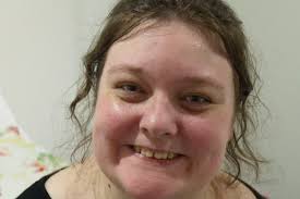 Fundraiser by Graeme Rouillon : Special Needs Daughter Orthopedic Surgery