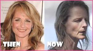 There's definitely a good reason to believe that helen hunt has had some sort of work done, but we can't say for sure. What On Earth Happened To Helen Hunt S Face Steemit
