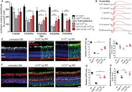 Large wall shelves feel at home in the entryway, living room and bedroom. Prevention Of Photoreceptor Cell Loss In A Cln6nclf Mouse Model Of Batten Disease Requires Cln6 Gene Transfer To Bipolar Cells Molecular Therapy