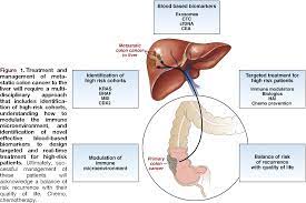 In rare cases, breast cancer does spread to the colon. Figure 1 From Colorectal Cancer Liver Metastasis Evolving Paradigms And Future Directions Semantic Scholar
