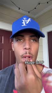 Black Comedian Embracing His Unique Feature