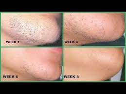First of all, your pubic hairs aren't people, so they don't decide on their own whether to grow or not. Don T Shave Remove Chin Hair And Upper Lips Hair For Good No Shave No Wax Hair Remover Youtube In 2021 Chin Hair Lip Hair Upper Lip Hair