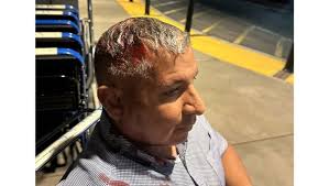 Man shot in head with 'less lethal' projectile at Santa Ana protest wants  $50 million from OC