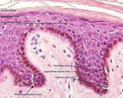 Incidence of merkel cell carcinoma in renal transplant recipients. Anatomy Gross Anatomy Physiology Cells Cytology Cell Physiology Organelles Tissues Histology Organs Regional Anatomy Organ