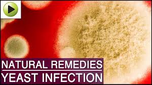 Yeast Infection Natural Ayurvedic Home Remedies Youtube