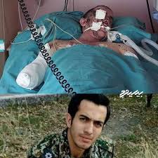 شهید مدافع حرم حامد جوانی که بدون ۲ دست و ۲ چشم به شهادت - ویسگون