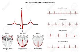 Normal And Abnormal Heart Rate Infographic Diagram Including