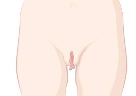 Aus meiner scheide hängt immer so ein etwa 1 cm langer zipfel raus. Vulva Typ Liebe Und Beziehung Vagina