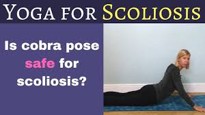Also, consult your doctor before using yoga as a form of therapy. Safe Cobra Pose For Scoliosis And Kyphosis Youtube