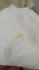 Flujo Amarillo Claro Blanco Con 9 Semanas Sera Normal Buscando Bebe Babycenter