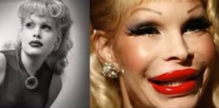 Making a plastic mold can be done in a few steps if you want to make copies of an existing object, according to bright hub engineering. 17 Celebrity Before And After Plastic Surgery Disasters